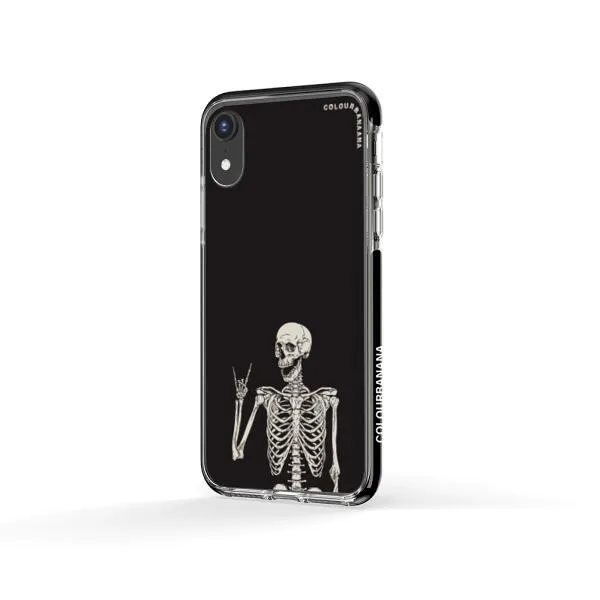 iPhone Case - Human Skeleton Posing